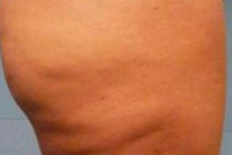 gambe prima