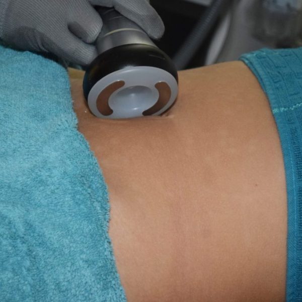 vacuum terapia